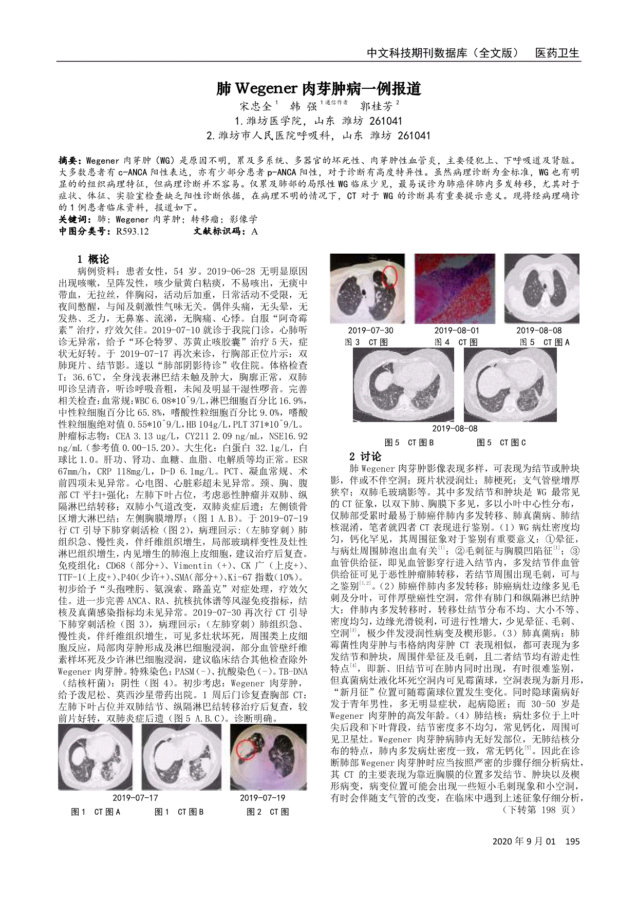 肺韦格纳肉芽肿病ct征象分析[j.放射学实践,2013,28(11:1128-1131.