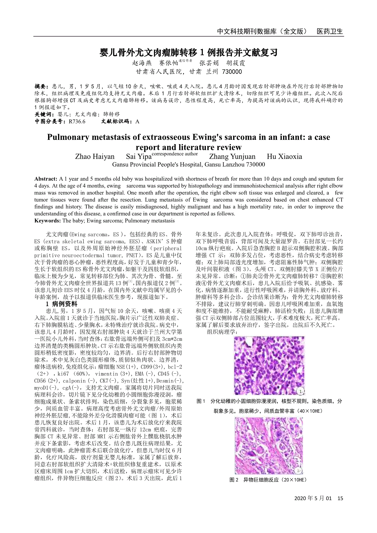 婴儿骨外尤文肉瘤肺转移1例报告并文献复习