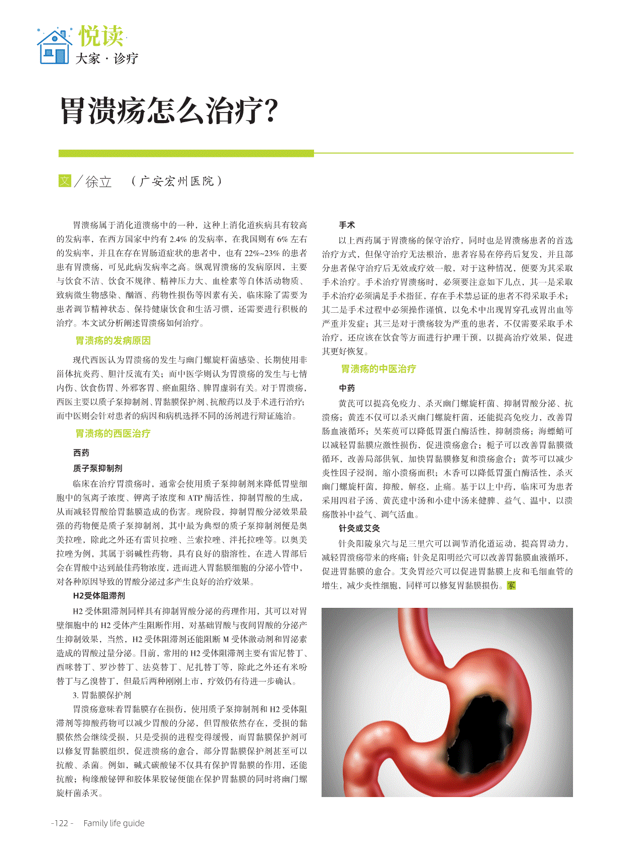 下旬刊》2020年 第02期122-122页 共1页【关键词】胃溃疡治疗【分 类