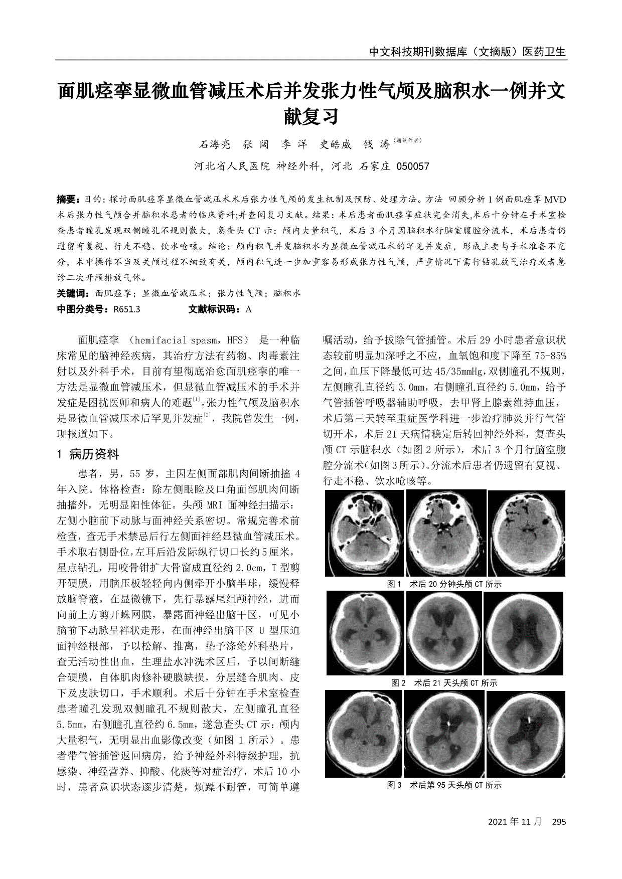 面肌痉挛显微血管减压术后并发张力性气颅及脑积水一例并文献复习
